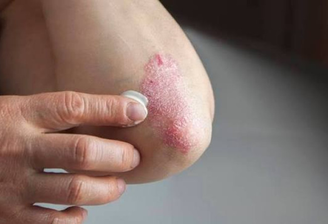 A exclusão social de indivíduos com doenças dermatológicas visíveis